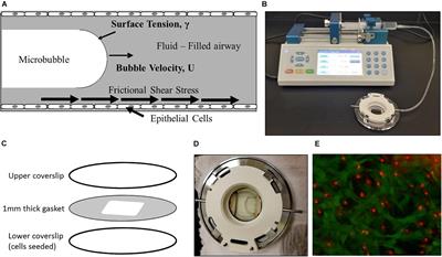 Nitric Oxide Releasing Hydrogel Nanoparticles Decreases Epithelial Cell Injuries Associated With Airway Reopening